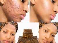 Savon noir africain